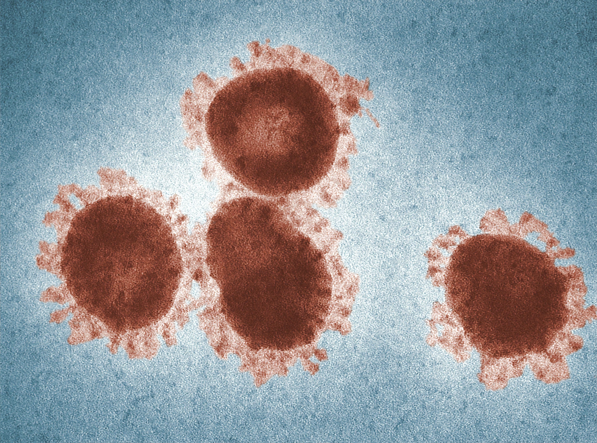 Tackle Today: Coronavirus Updates 🦠 - This 1975, digitally colorized transmission electron microscopic (TEM) image, depicted four avian infectious bronchitis virus (IBV) virions, which are Coronaviridae family members. IBV is a highly contagious pathogen, which infects poultry of all ages, affecting a number of organ systems, including the respiratory and urogenital organs. Photo by CDC on Unsplash